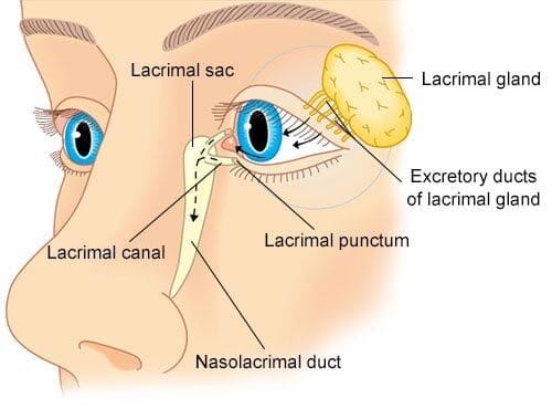 Tear Gland Inflammation (Dacryoadenitis)