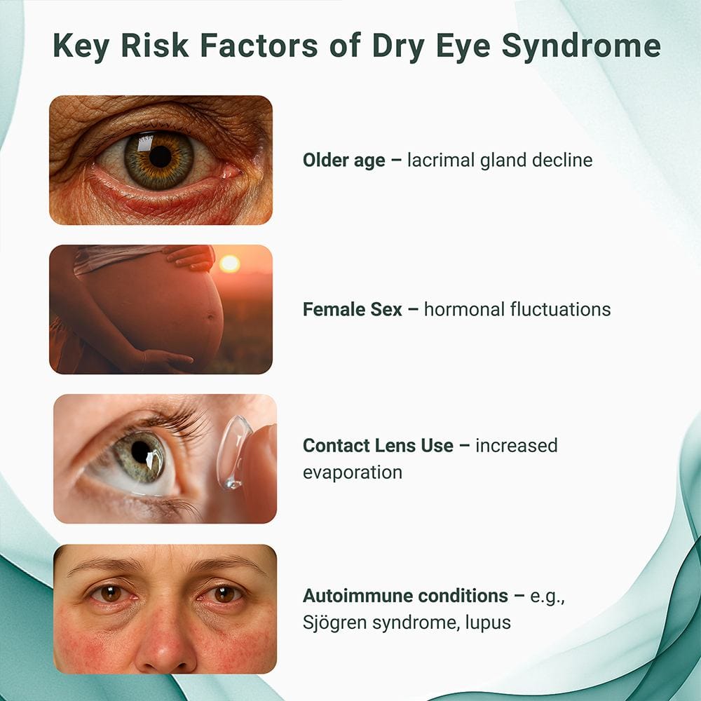 Key Risk Factors of Dry Eye Syndrome